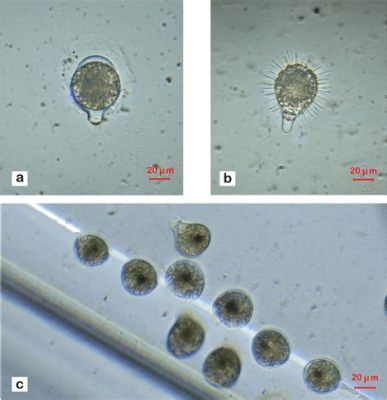  Strombidium! A Tiny Ciliate With an Enormous Appetite for Bacteria