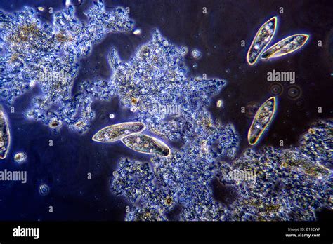   Paramecium: Kuten pieni tanssiva vesisirkkeli, se on mestari selviytymisessä mikroskooppisen maailman kaoksessa!